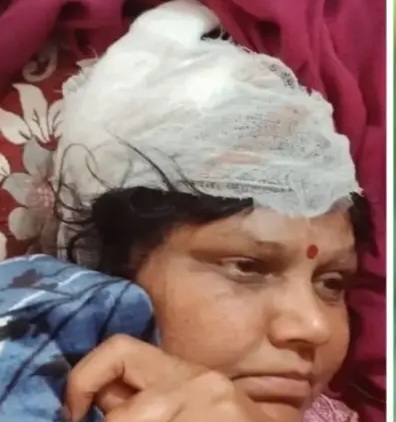 stray-dog-attack-1767029286593-780x470